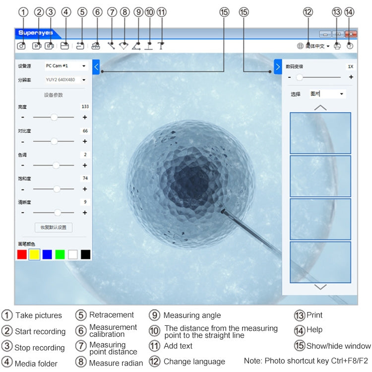 Supereyes Y001 Endoscopio Lente 4mm Para Oídos Médicos
