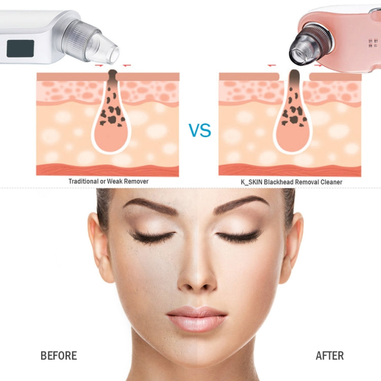 K Skin 3Niveles Intensidad Limpiador De Poros Facial