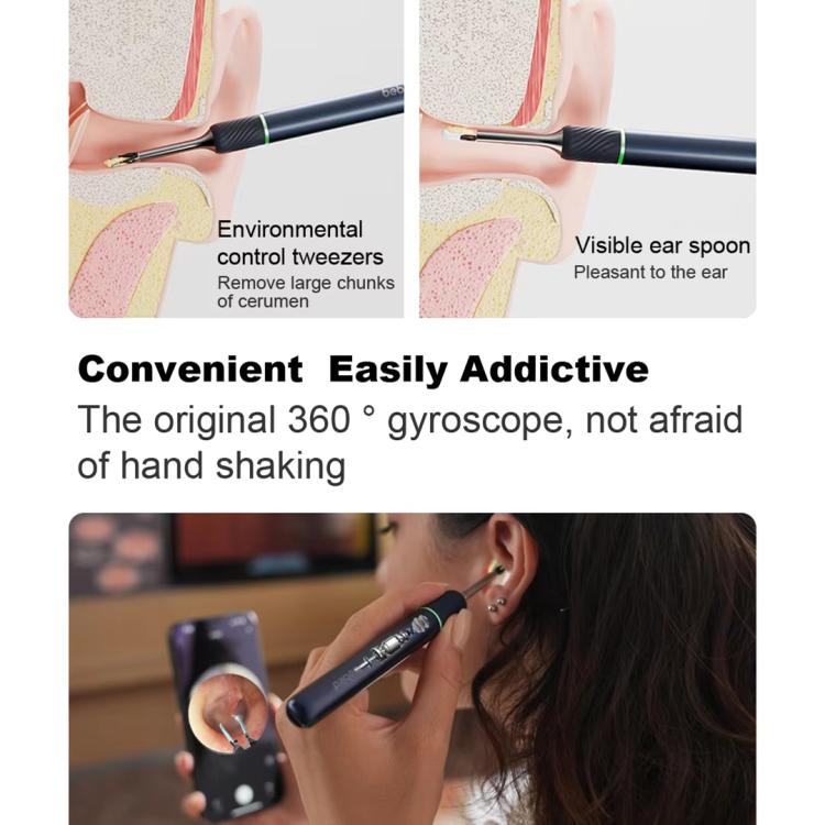 Bebird Note5 Pro Endoscopio Visual Para Oido Kit Completo
