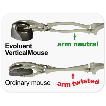 Evoluent VerticalMouse 4 Bluetooth para Mac Mouse Vertical Dcho Batería AA