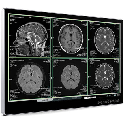 Lilliput Aimedik MD31 Monitor Quirúrgico UHD 4K 31.5" HDR 10-Bit DICOM