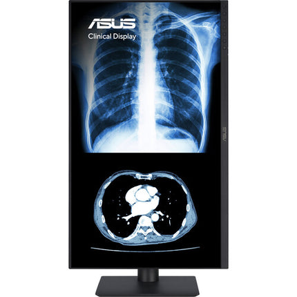 ASUS Monitor Clínico 23.8" QHD 2560x1440 USB-C IPS Antibacterial