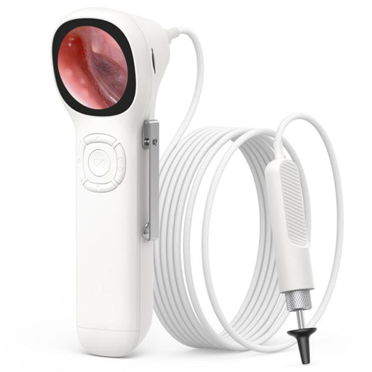 TESLONG SA160 Otoscopio Visual Portátil Pantalla 1.45In Para Inspección Auditiva