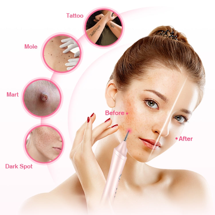 K-SKIN KD306 Máquina Láser Facial Pluma Plasma 3Niveles